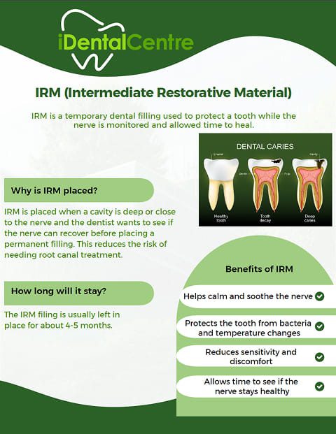 Immediate-Restorative-Material-IRM